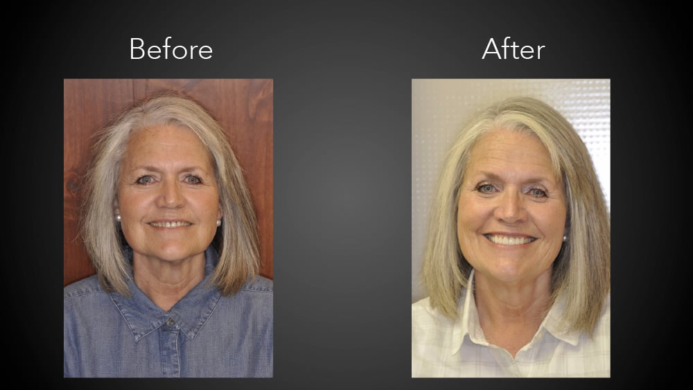 OUR SERVICES | Smile Center Utah